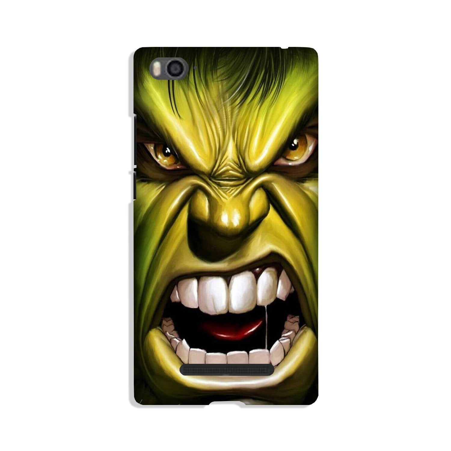 Hulk Superhero Case for Redmi 4A (Design - 121) Hulk Superhero Case for Redmi 4A (Design - 121)