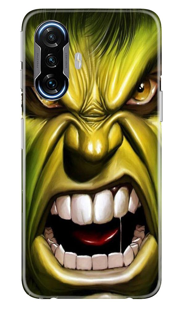 Hulk Superhero Mobile Back Case for Poco F3 GT 5G (Design - 121) Hulk Superhero Case for Poco F3 GT 5G (Design - 121)