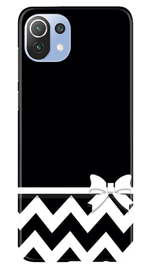 Gift Wrap7 Mobile Back Case for Mi 11 5G (Design - 49) Gift Wrap7 Case for Mi 11 5G