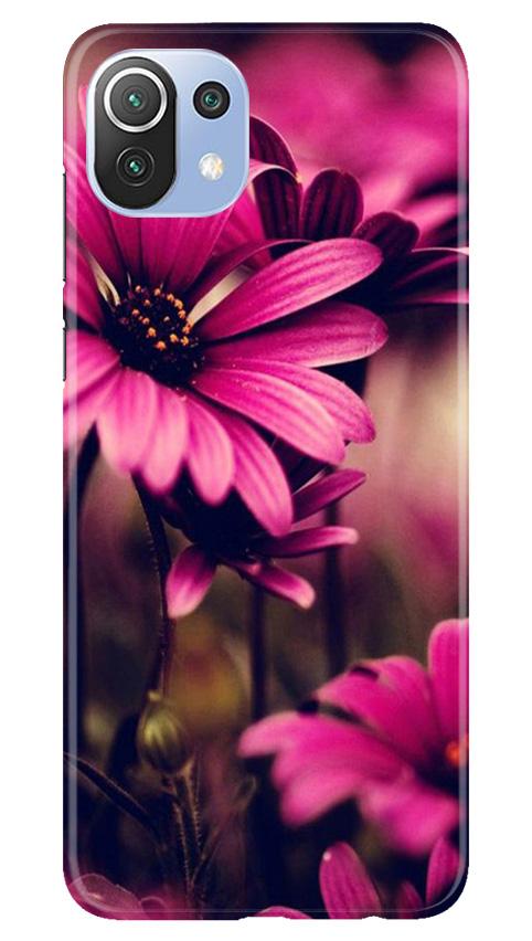 Purple Daisy Mobile Back Case for Mi 11 Lite 5G (Design - 65) Purple Daisy Case for Mi 11 Lite 5G