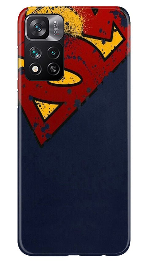 Superman Superhero Mobile Back Case for Xiaomi Mi 11i 5G (Design - 125) Superman Superhero Case for Xiaomi Mi 11i 5G (Design - 125)