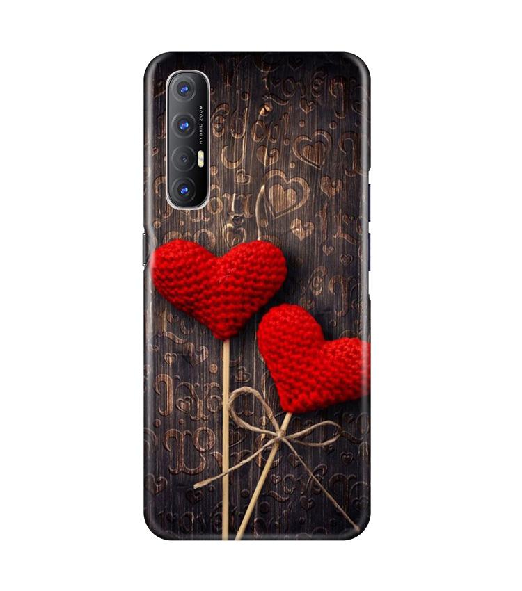 Red Hearts Mobile Back Case for Oppo Reno3 Pro (Design - 80) Red Hearts Case for Oppo Reno3 Pro