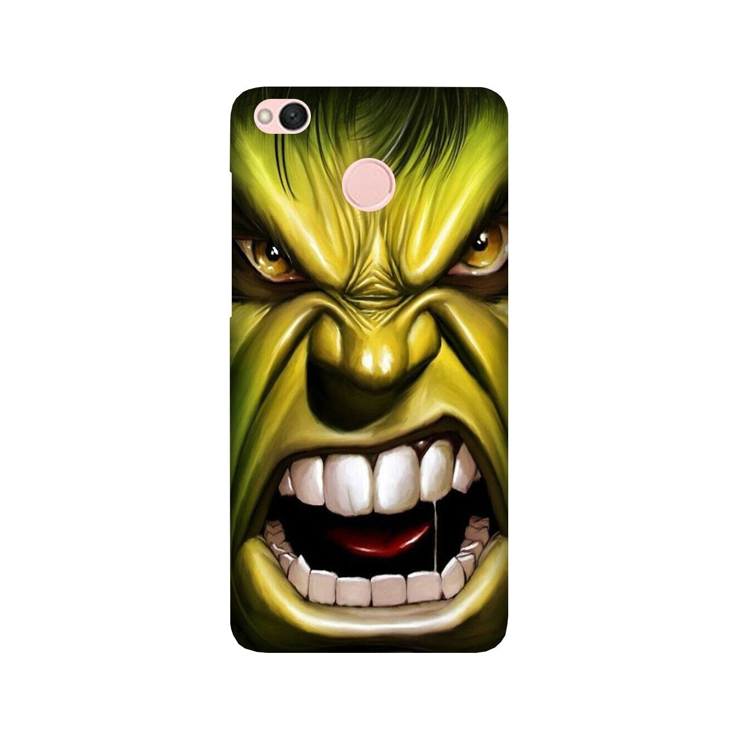 Hulk Superhero Mobile Back Case for Redmi 4 (Design - 121) Hulk Superhero Case for Redmi 4 (Design - 121)