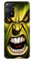 Hulk Superhero Case for Redmi Note 11 Pro Plus  (Design - 121)