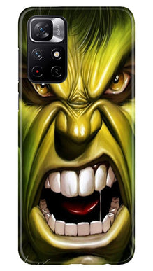 Hulk Superhero Mobile Back Case for Redmi Note 11T 5G  (Design - 121)