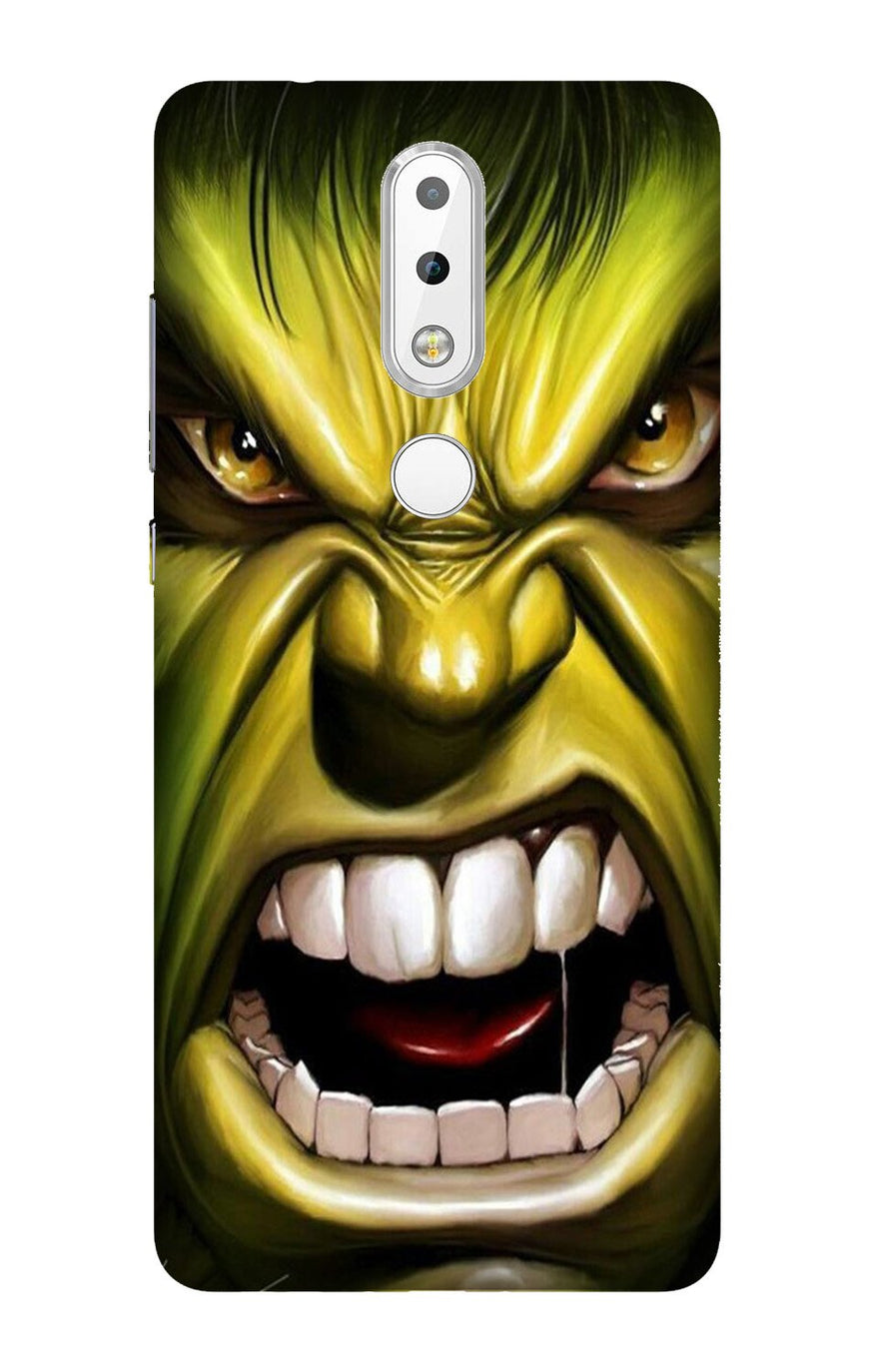 Hulk Superhero Case for Nokia 3.1 Plus  (Design - 121)