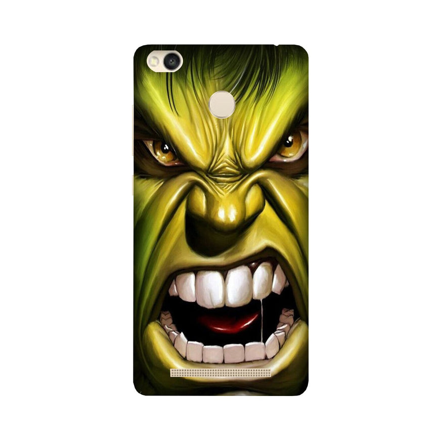 Hulk Superhero Case for Redmi 3S Prime  (Design - 121)
