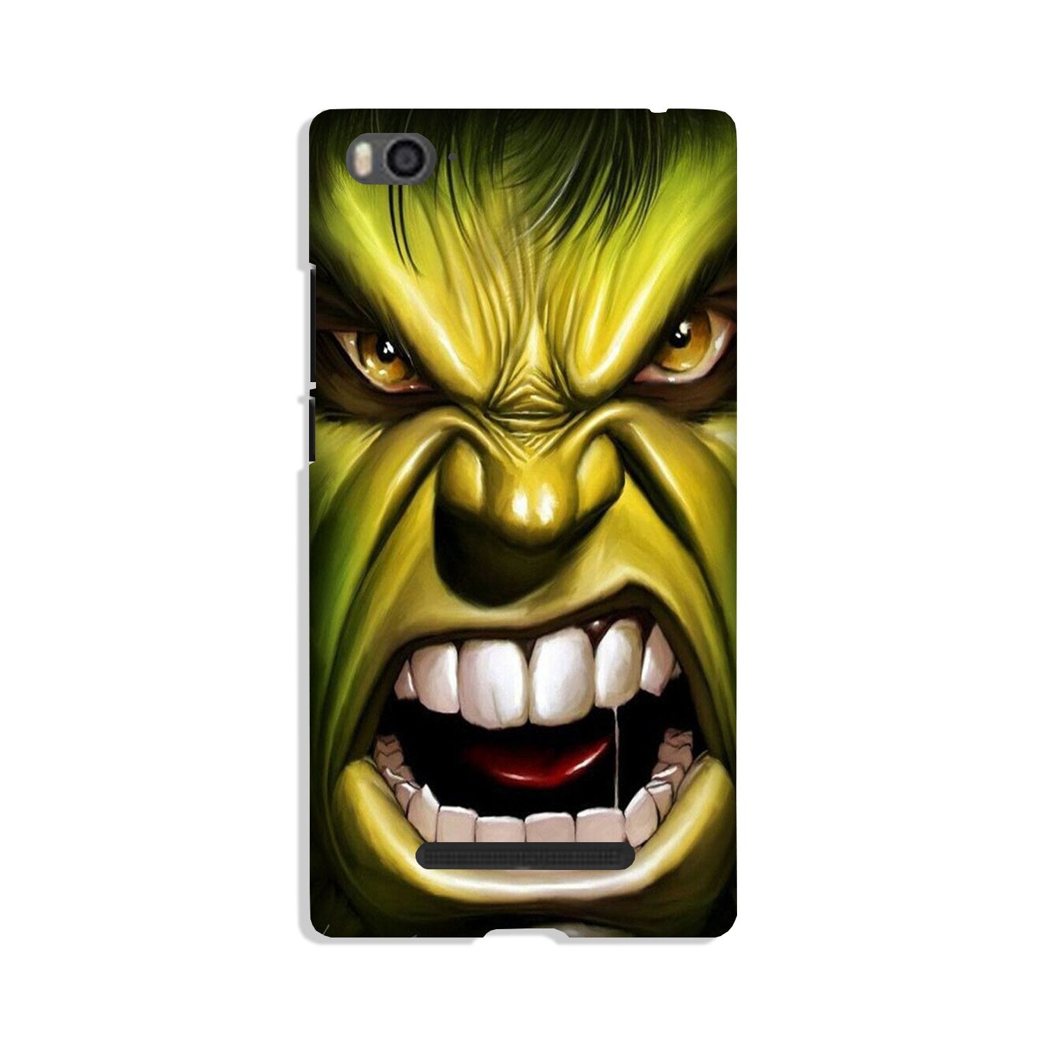 Hulk Superhero Case for Redmi 4A  (Design - 121)