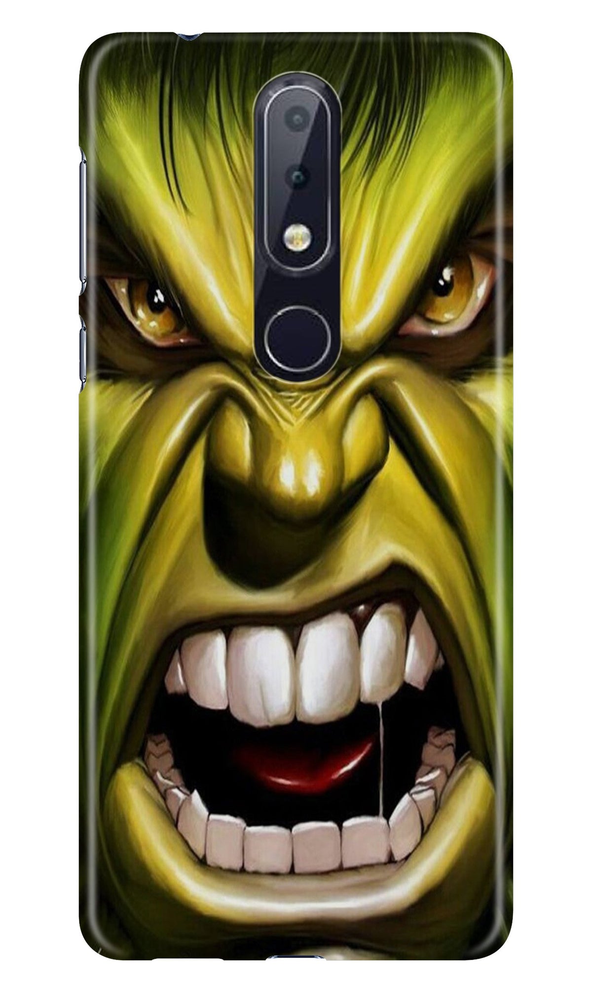 Hulk Superhero Case for Nokia 8.1 Plus  (Design - 121)