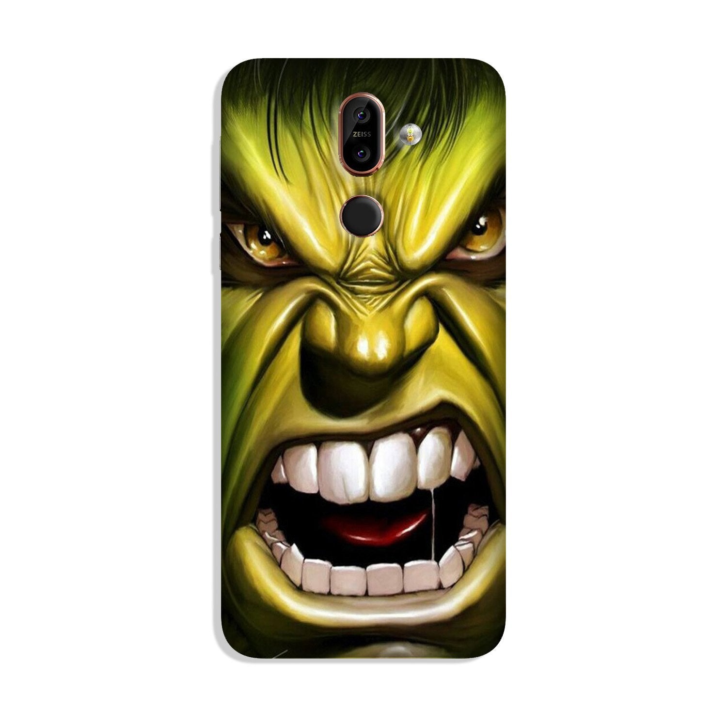 Hulk Superhero Case for Nokia 8.1(Design - 121)