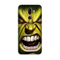 Hulk Superhero Case for Nokia 8.1  (Design - 121)