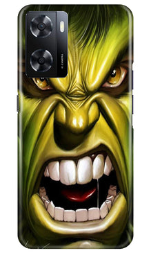 Hulk Superhero Mobile Back Case for Oppo A57 2022  (Design - 121)