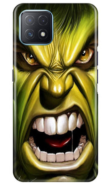 Hulk Superhero Mobile Back Case for Oppo A73 5G  (Design - 121)