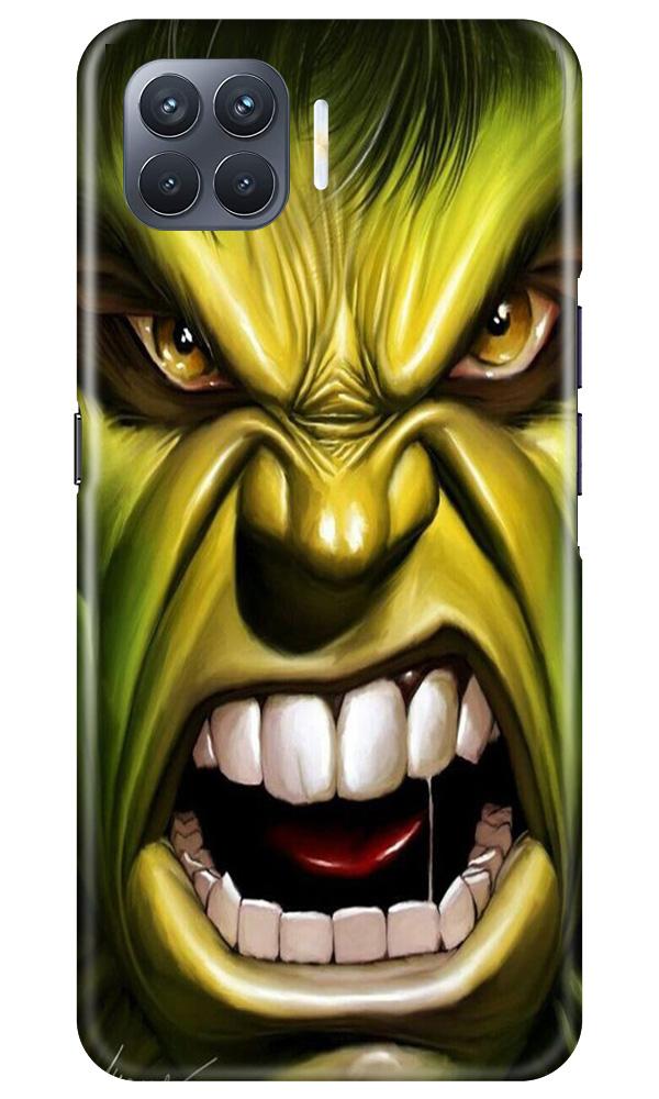 Hulk Superhero Case for Oppo F17 Pro  (Design - 121)