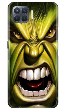 Hulk Superhero Case for Oppo F17 Pro(Design - 121)