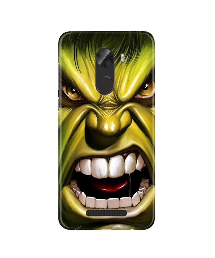 Hulk Superhero Case for Gionee A1 Lite  (Design - 121)
