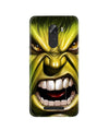 Hulk Superhero Case for Gionee A1 Lite  (Design - 121)