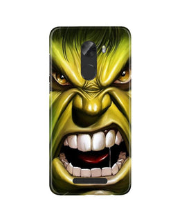 Hulk Superhero Case for Gionee A1 Lite(Design - 121)