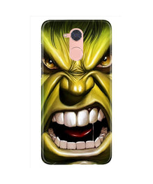 Hulk Superhero Mobile Back Case for Gionee S6 Pro  (Design - 121)