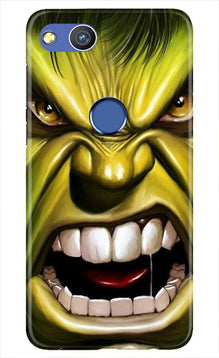 Hulk Superhero Mobile Back Case for Honor 8 Lite  (Design - 121)