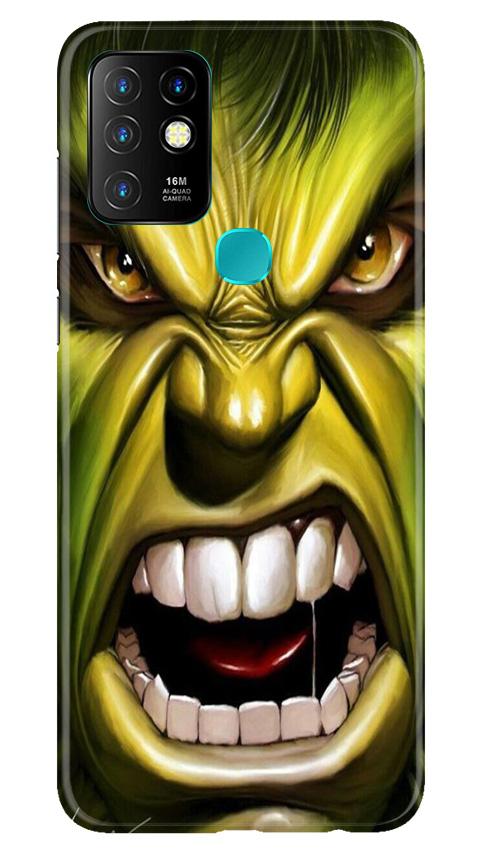 Hulk Superhero Case for Infinix Hot 10  (Design - 121)