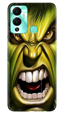 Hulk Superhero Mobile Back Case for Infinix Hot 12 Play  (Design - 121)