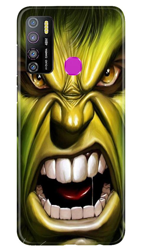 Hulk Superhero Case for Infinix Hot 9 Pro  (Design - 121)