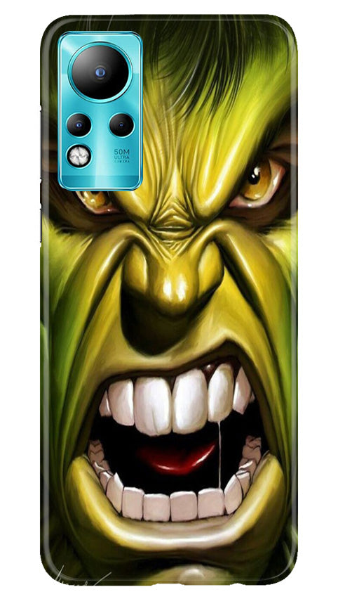 Hulk Superhero Case for Infinix Note 11  (Design - 121)
