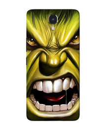 Hulk Superhero Mobile Back Case for Infinix Note 4  (Design - 121)