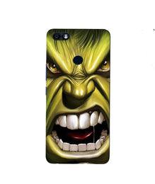 Hulk Superhero Mobile Back Case for Infinix Note 5 / Note 5 Pro  (Design - 121)