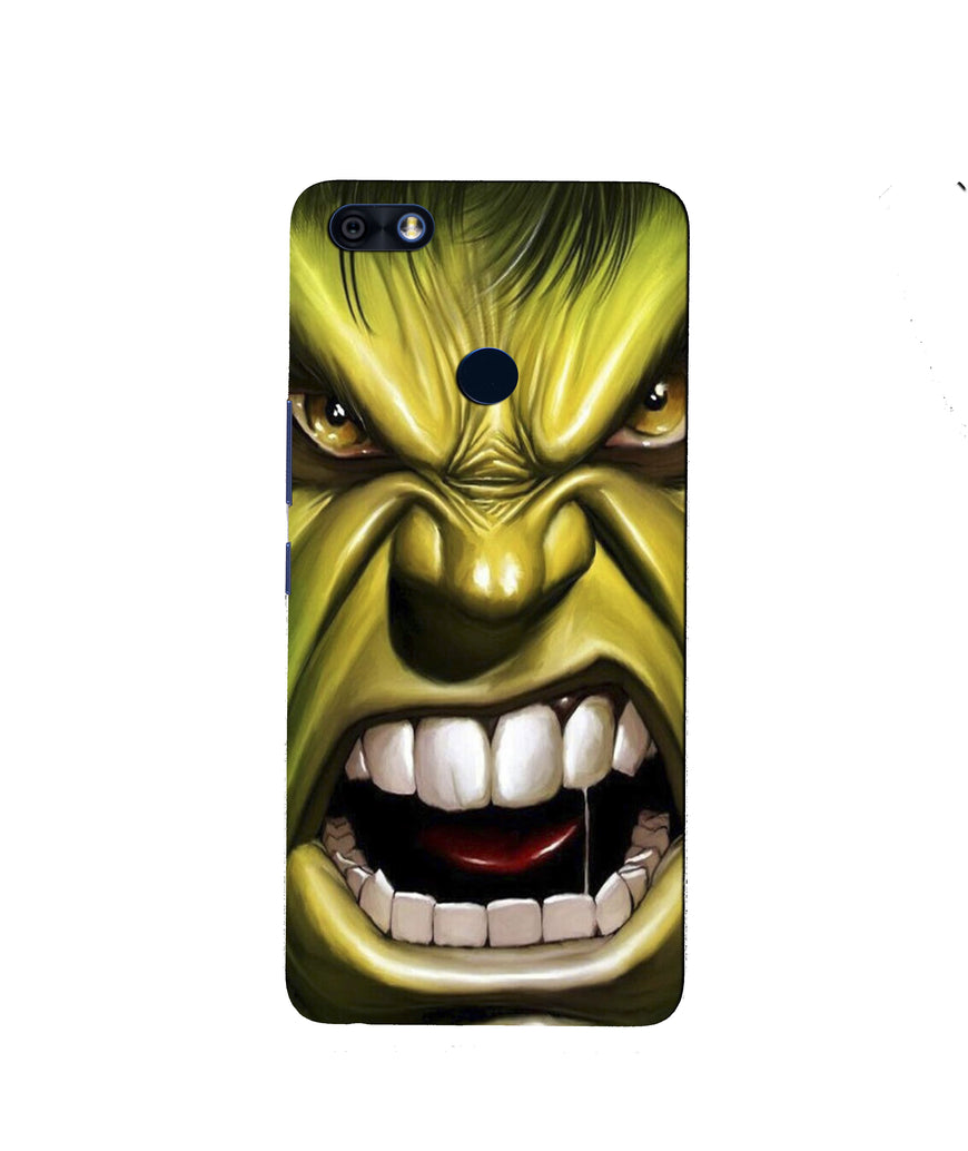 Hulk Superhero Case for Infinix Note 5 / Note 5 Pro  (Design - 121)