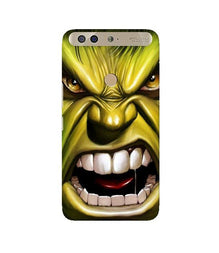 Hulk Superhero Mobile Back Case for Infinix Zero 5  (Design - 121)