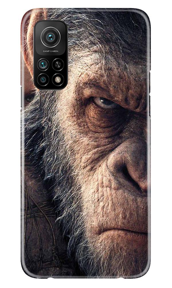 Angry Ape Mobile Back Case for Mi 10T (Design - 316)