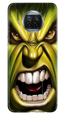 Hulk Superhero Mobile Back Case for Xiaomi Mi 10i  (Design - 121)