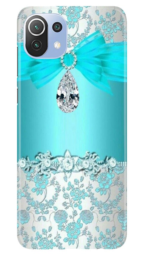 Shinny Blue Background Case for Mi 11 5G