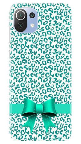 Gift Wrap6 Case for Mi 11 Lite 5G 