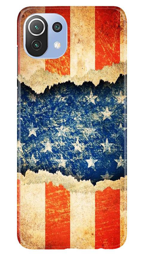 United Kingdom Case for Mi 11 Lite 5G 