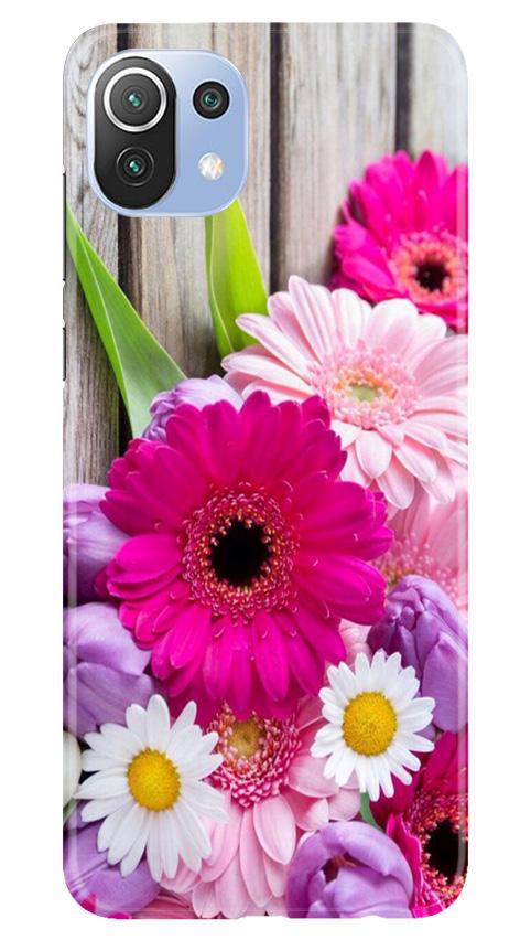 Coloful Daisy2 Case for Mi 11 Lite 5G 