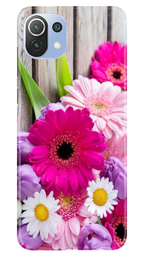 Coloful Daisy2 Case for Mi 11 5G