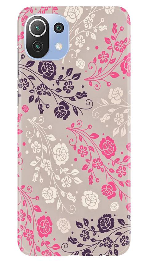 Pattern2 Case for Mi 11 Lite 5G 