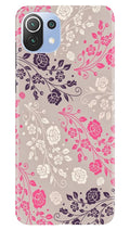 Pattern2 Case for Mi 11 5G