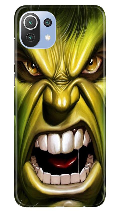 Hulk Superhero Case for Mi 11 Lite 5G   (Design - 121)