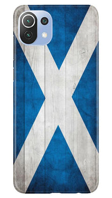 Designer Mobile Back Case for Mi 11 Lite 5G  (Design - 277)