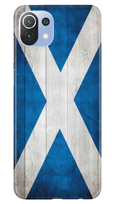 Designer Case for Mi 11 5G (Design No. 277)