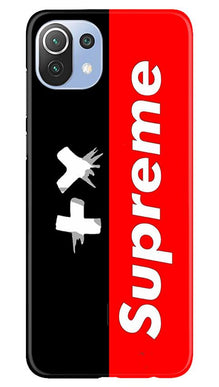 Supreme Mobile Back Case for Mi 11 Lite 5G (Design - 389)