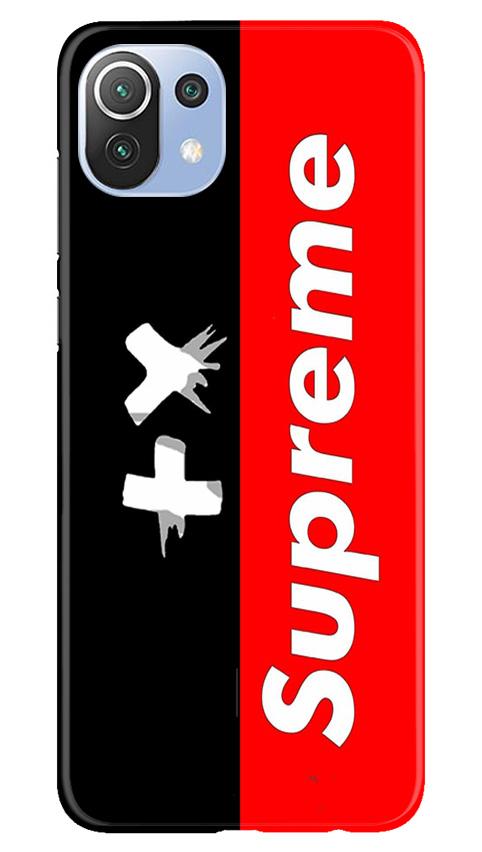Supreme Mobile Back Case for Mi 11 Lite 5G (Design - 389)