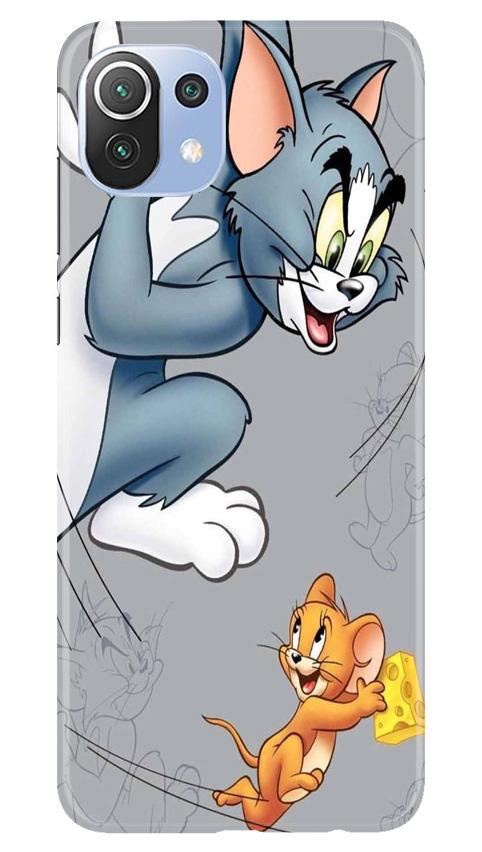 Tom n Jerry Mobile Back Case for Mi 11 Lite 5G (Design - 399)