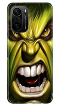 Hulk Superhero Case for Mi 11X Pro 5G  (Design - 121)