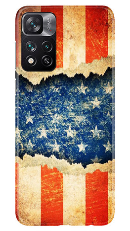 United Kingdom Case for Xiaomi Mi 11i 5G