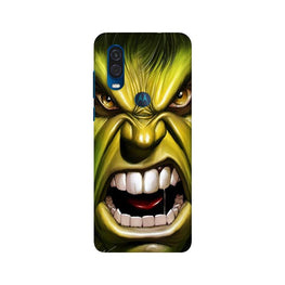 Hulk Superhero Case for Moto One Vision(Design - 121)